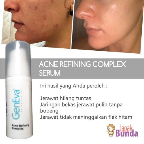 SERUM ACNE REFINING COMPLEX GENEVA 2 Serum Acne Refining Complex Geneva